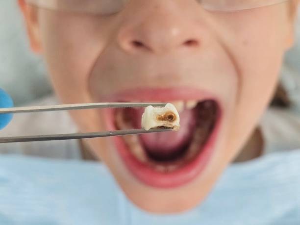 Best Emergency Dental Care for Broken or Chipped Teeth in Rincon Valley, AZ